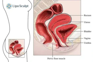 Treatment For A Leaky Bladder 2 How EM Chair treatment Coalville can help Leaky bladder issues. Read more now!